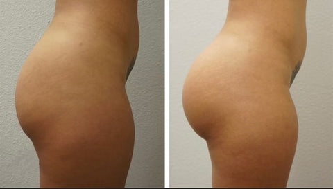 Butt Enhancement Cream