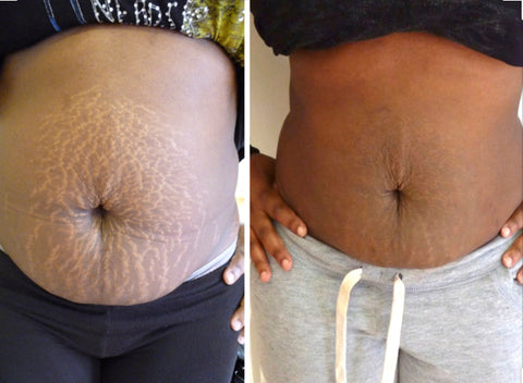 Waist Slimming Cream